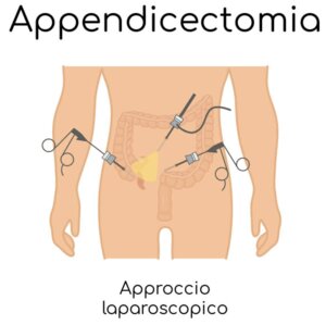 Appendicite-diagnosi Appendicite-diagnosi
