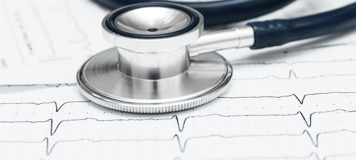 Sindrome di Brugada