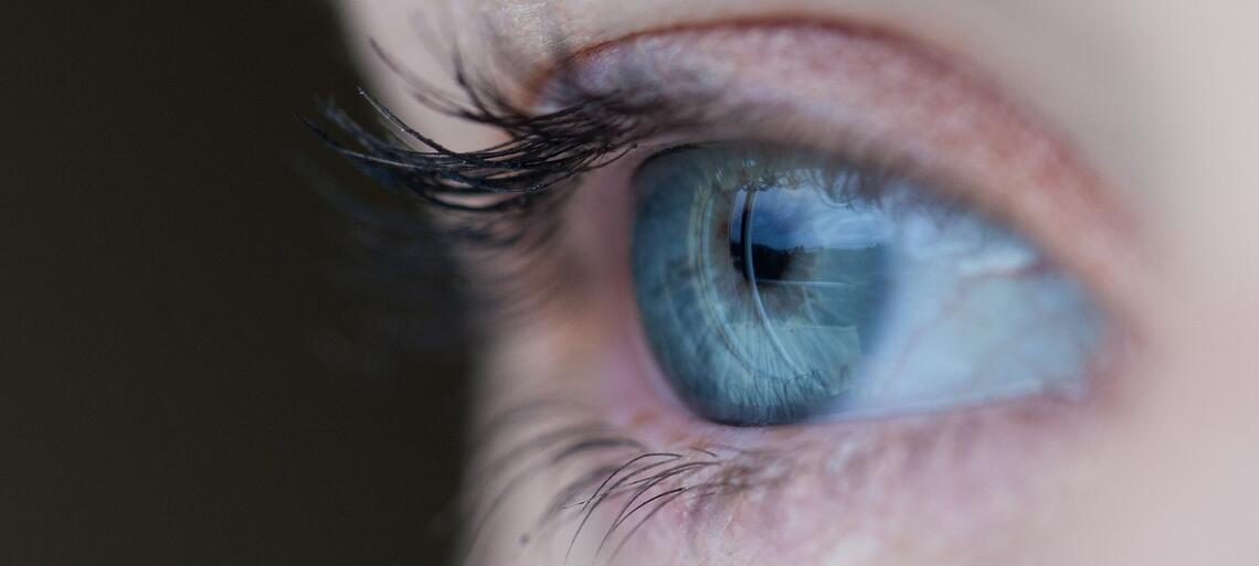 Glaucoma